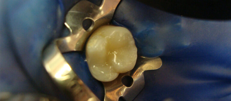 aesthetische-zahnheilkunde-6